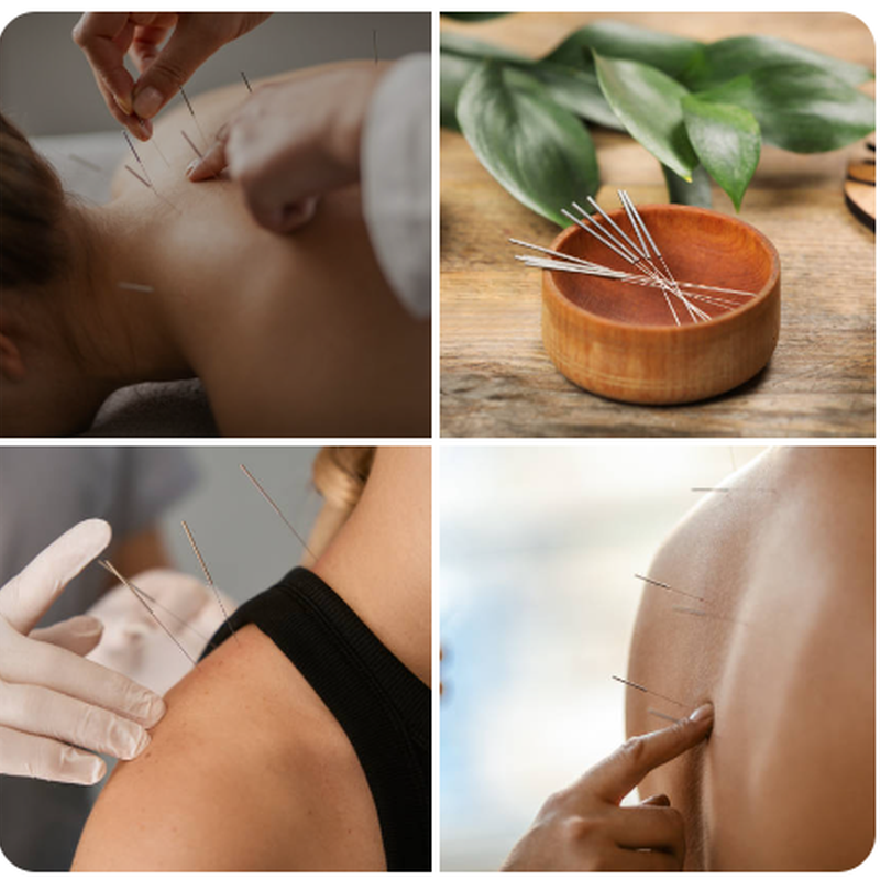 Akupunkturista / akupunkturistka – VITALEA Medical Wellness